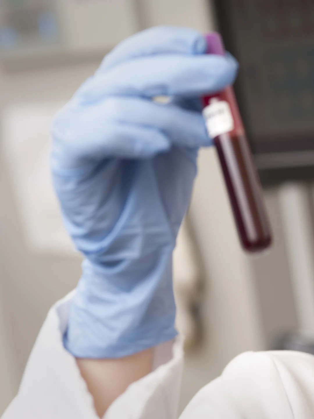Amostra de sangue em laboratório. National Eye Institute / Wikimedia Commons, CC BY 2.0. Imagem ilustrativa.