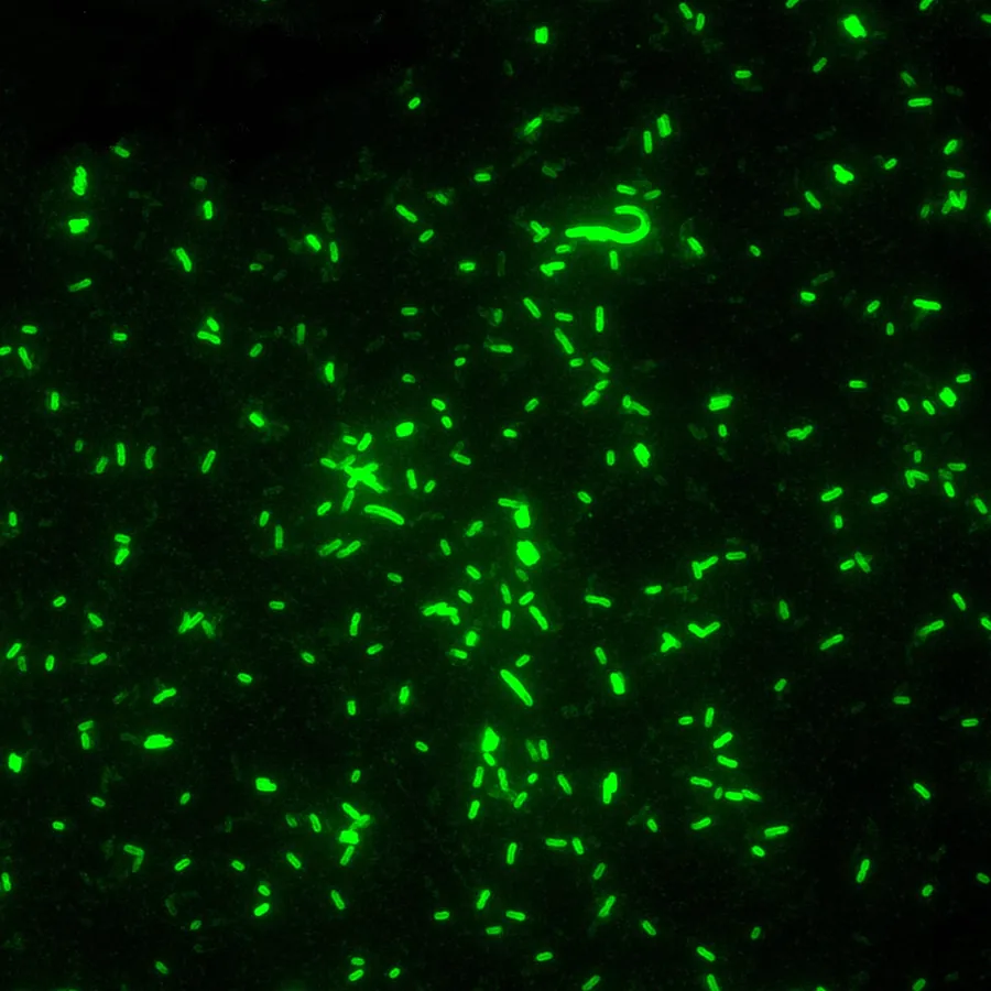 Bactéria da peste, Yersinia pestis, vista ao microscópio. CDC / Larry Stauffer / Wikimedia Commons, domínio público
